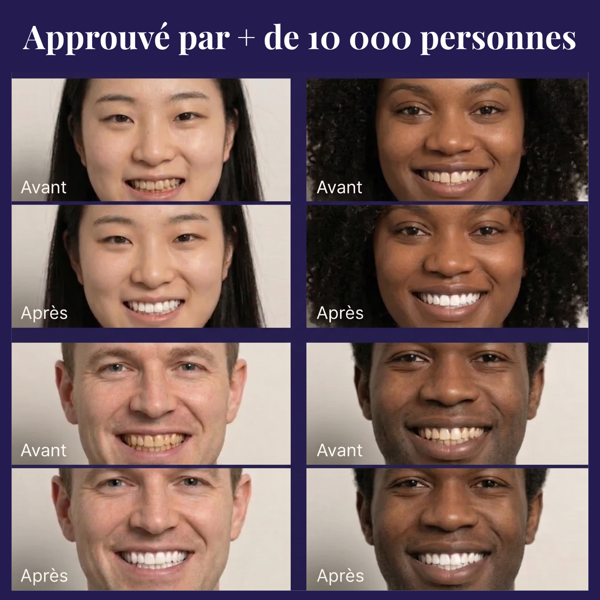Correcteur Violet — Sourire éclatant en 30 secondes