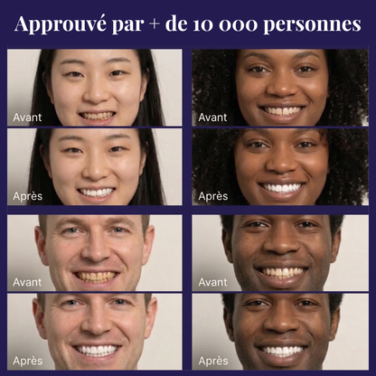 Correcteur Violet — Sourire éclatant en 30 secondes